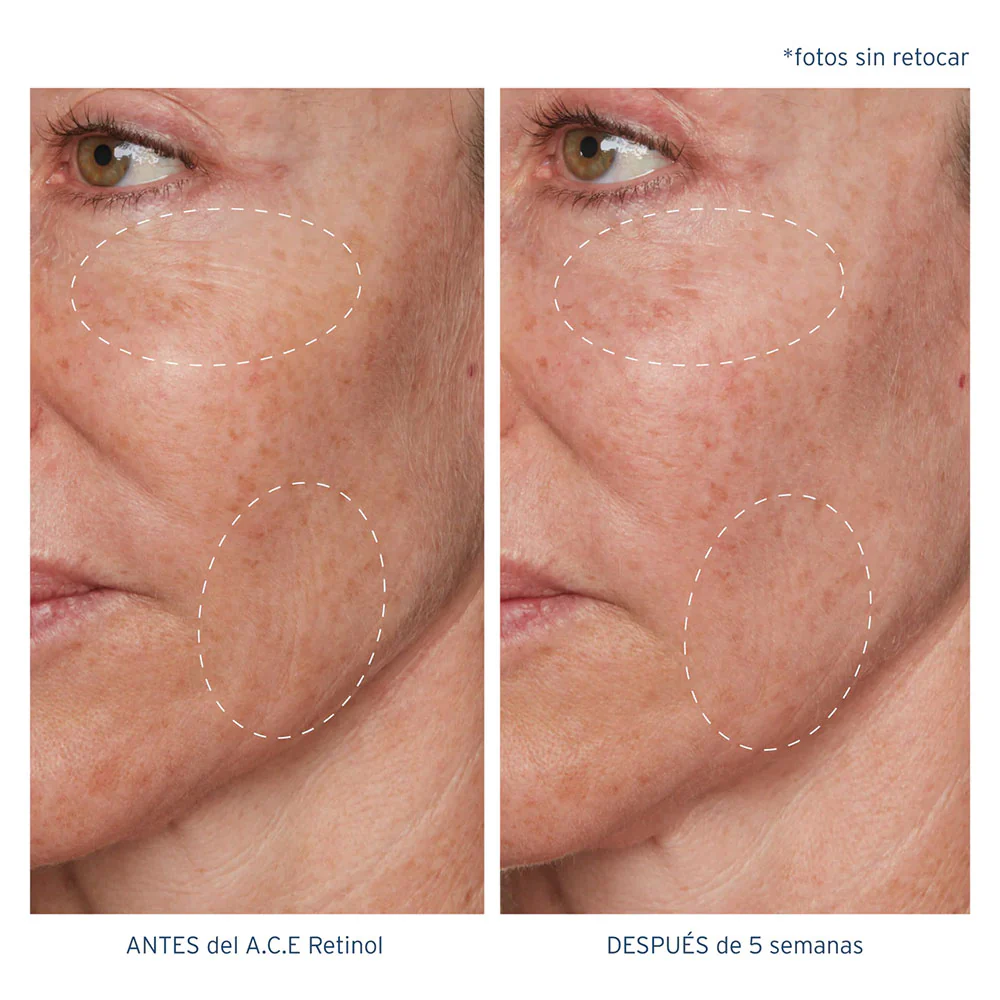 A.C.E. Aceite Regenerador Intensivo con Retinol - Image 4