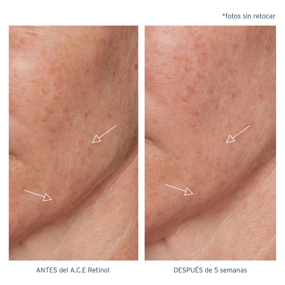 A.C.E. Aceite Regenerador Intensivo con Retinol - Image 6