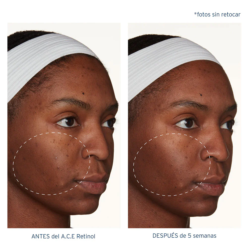 A.C.E. Aceite Regenerador Intensivo con Retinol - Image 7