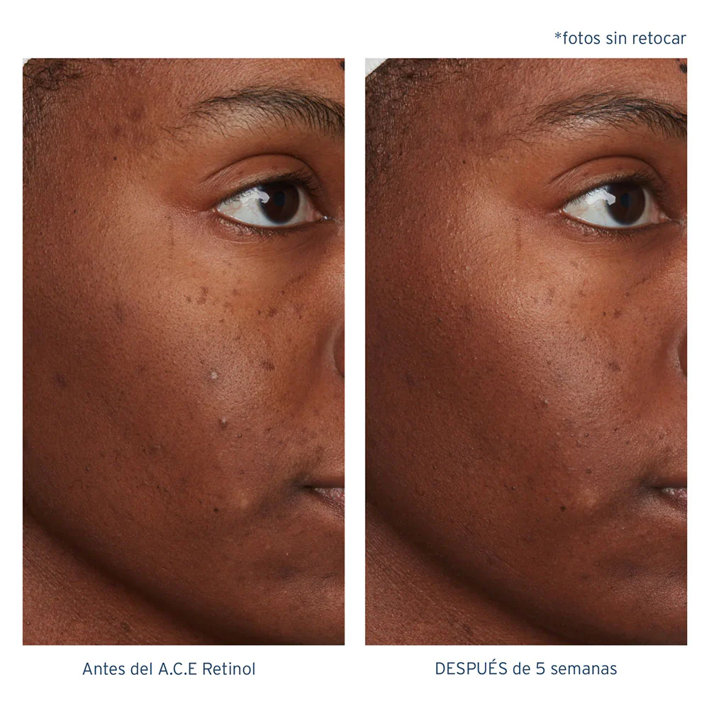 A.C.E. Aceite Regenerador Intensivo con Retinol - Image 8
