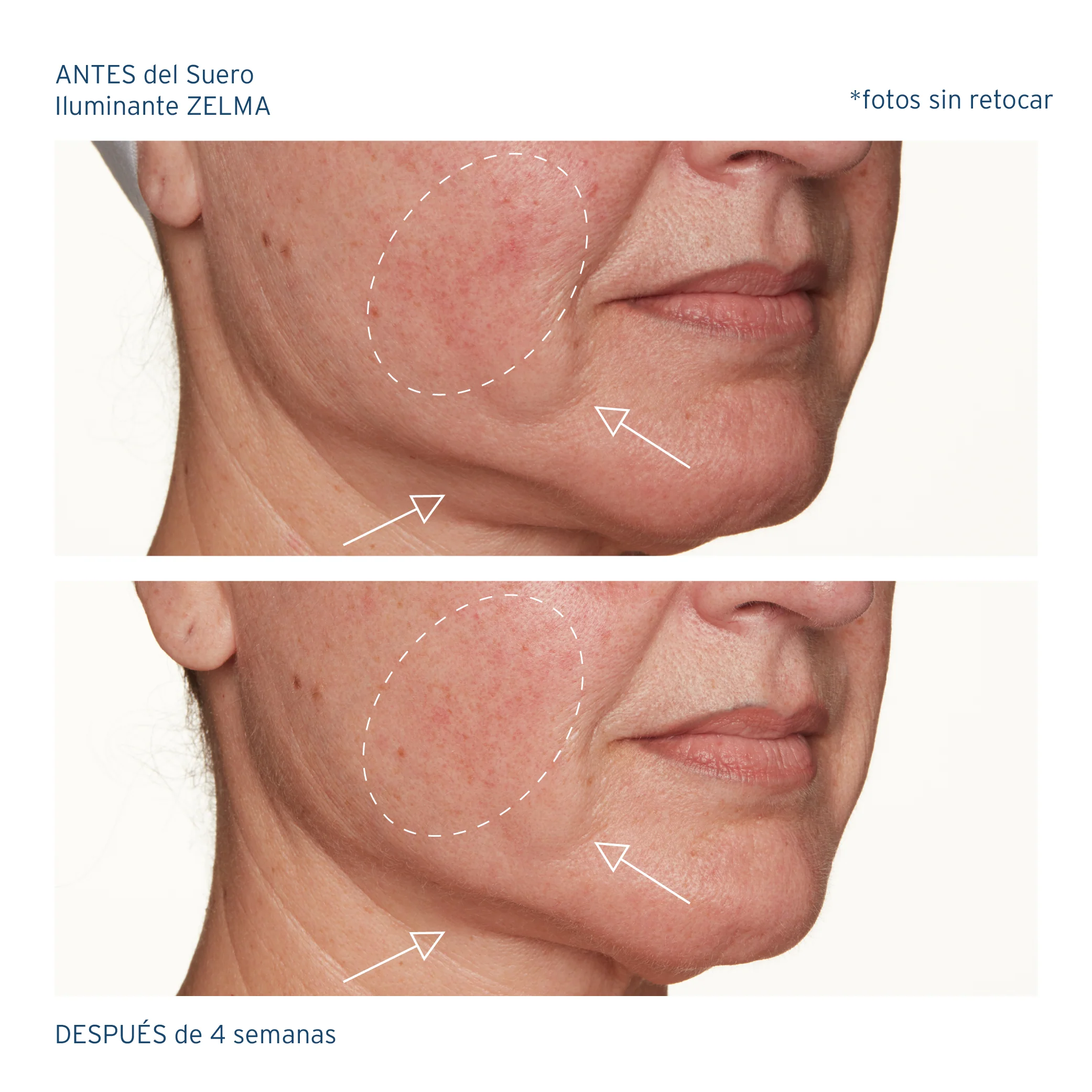 Set Antienvejecimiento Completo - Image 7