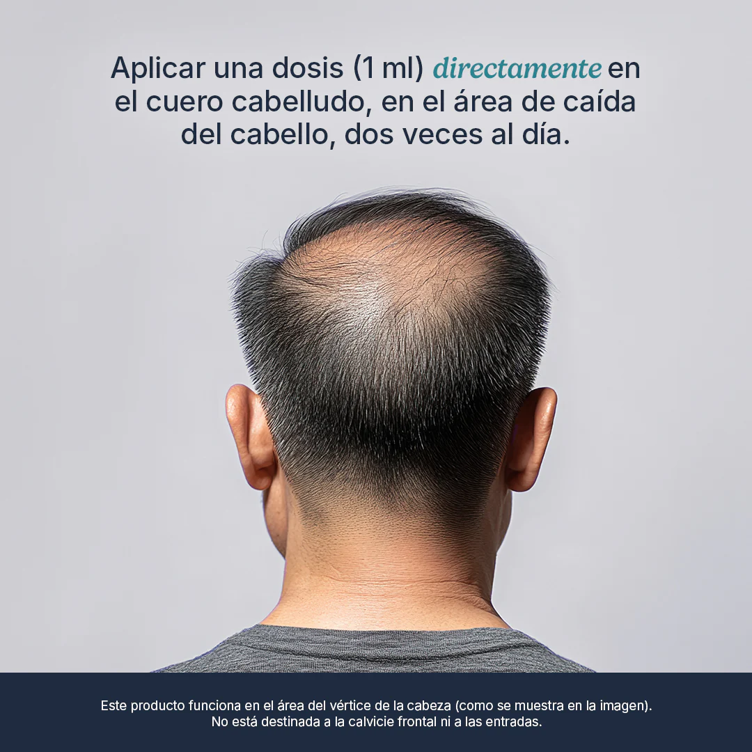 Men's Hair Regrowth - Image 7