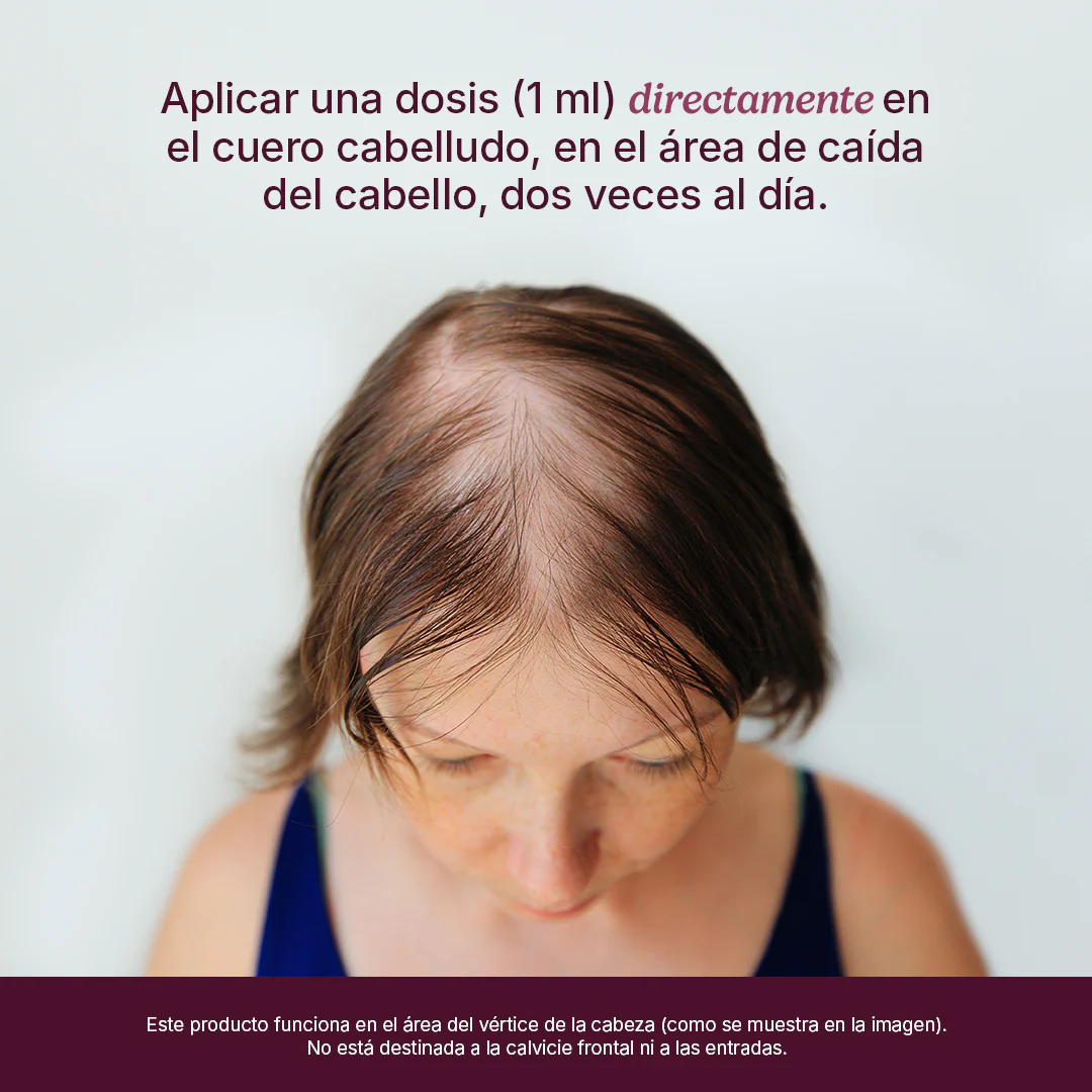 Women's Hair Regrowth - Image 7