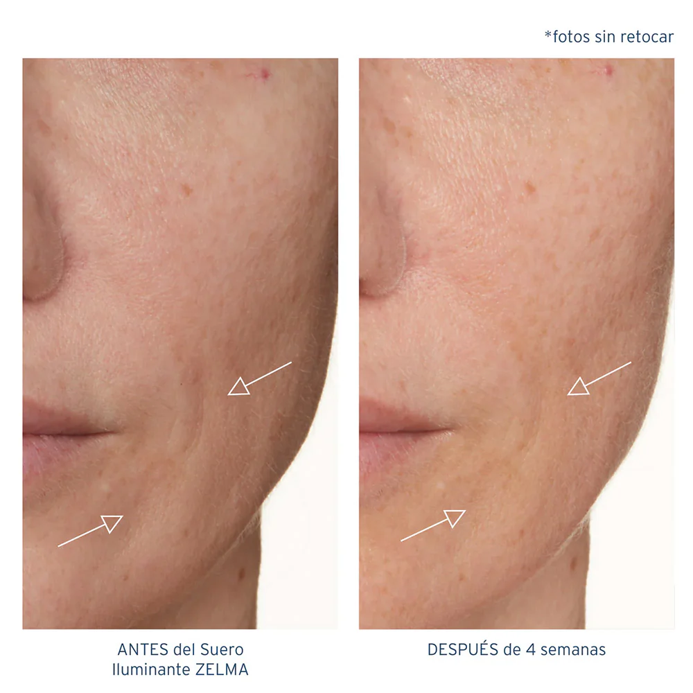 Suero Iluminante ZELMA - Image 3