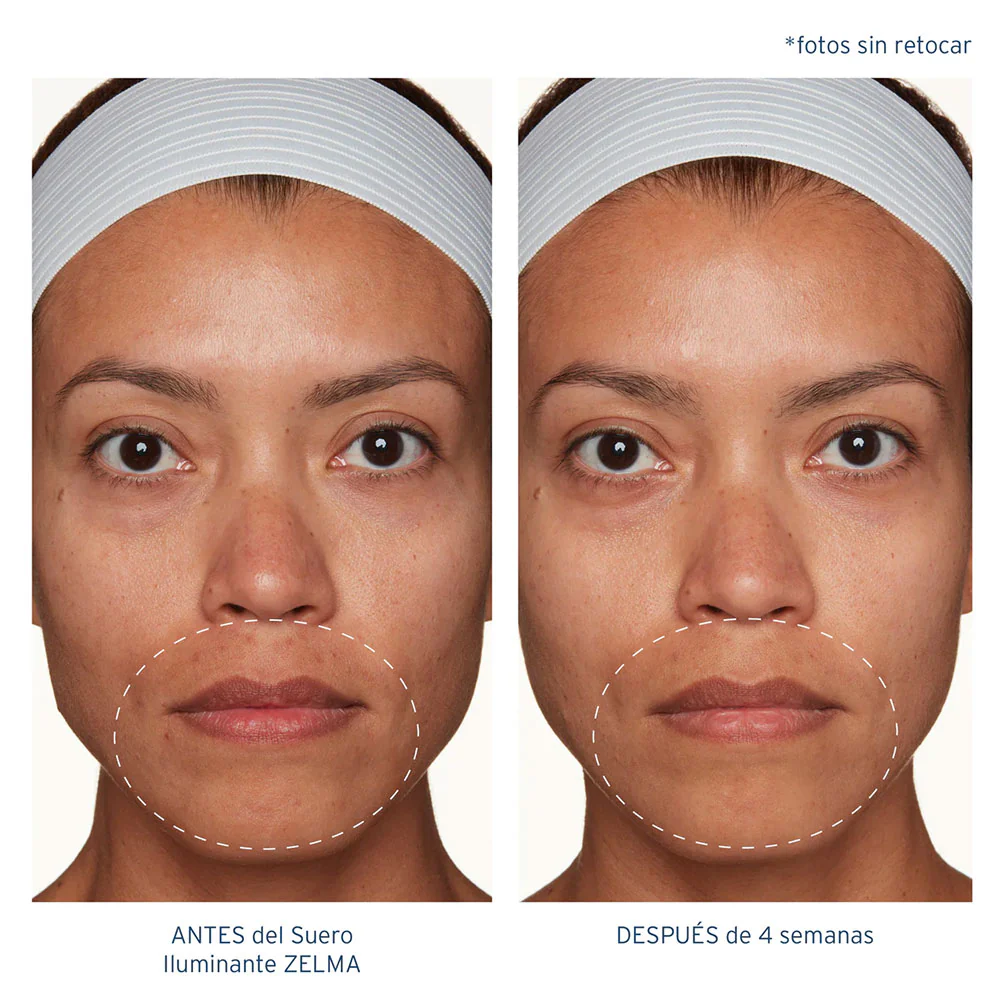 Suero Iluminante ZELMA - Image 4