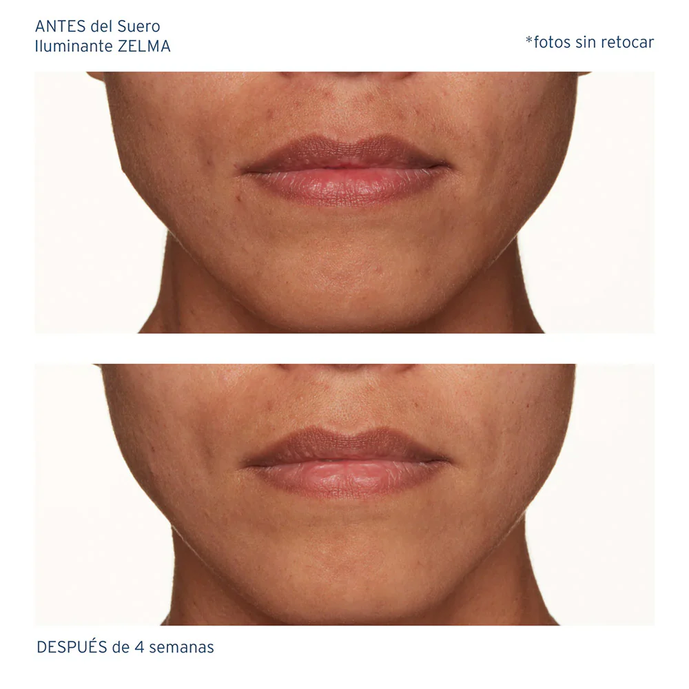 Suero Iluminante ZELMA - Image 5